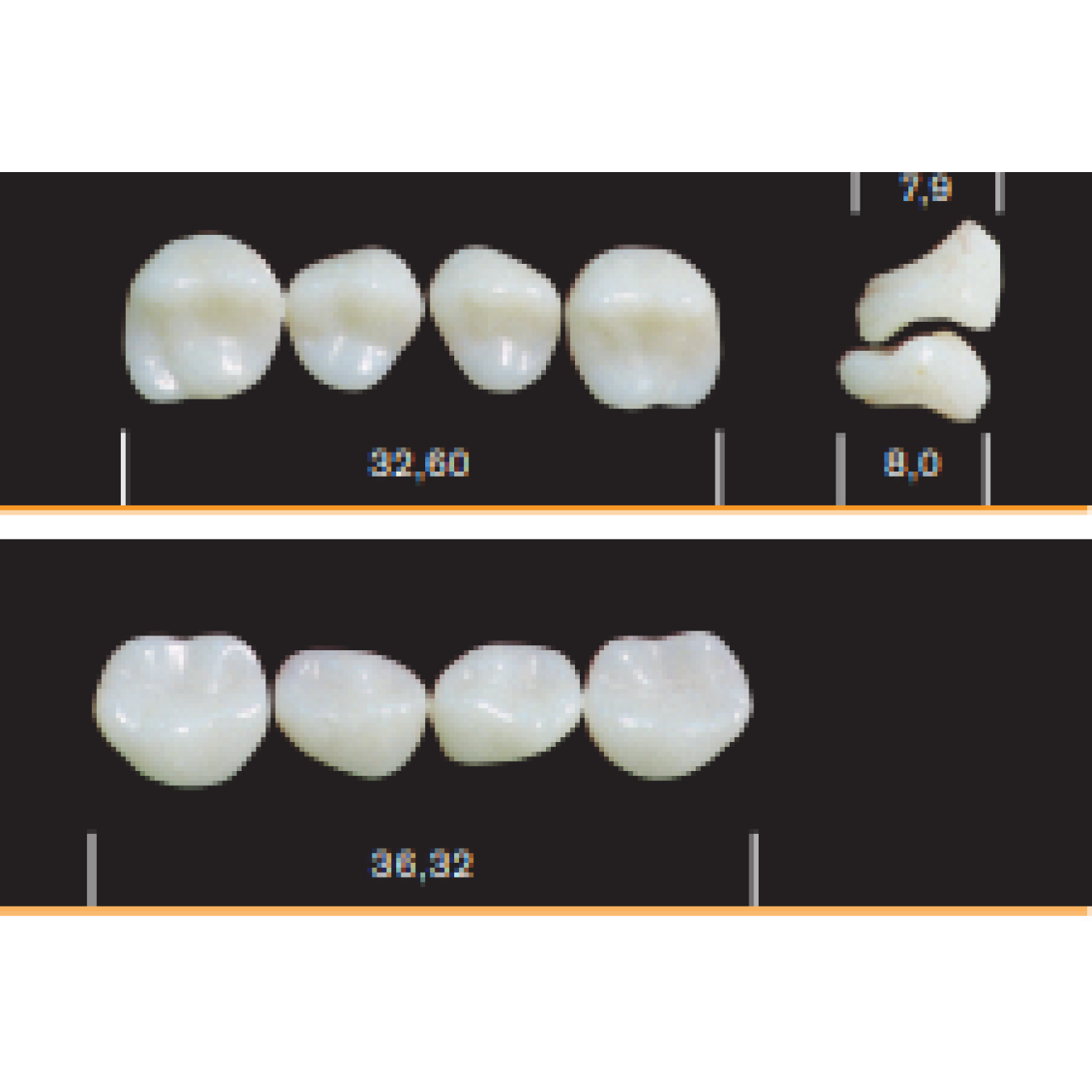Bambino Tooth Posteriors (4)