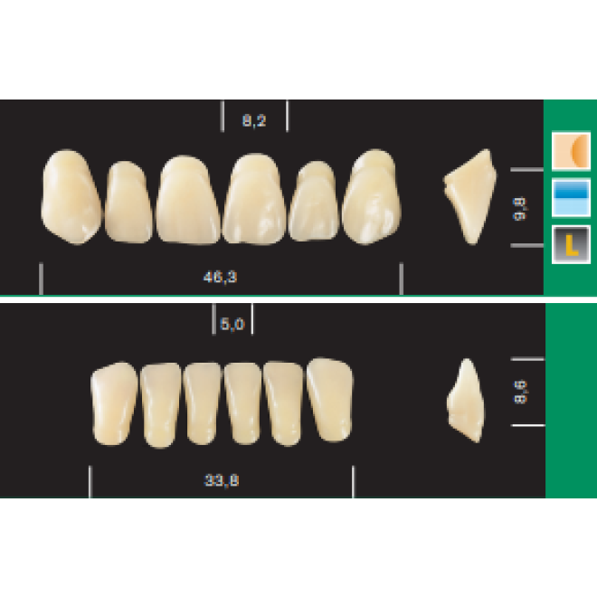Major Plus Anteriors (6)