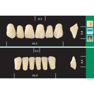 Major Plus / Major Plus Anteriors (6)